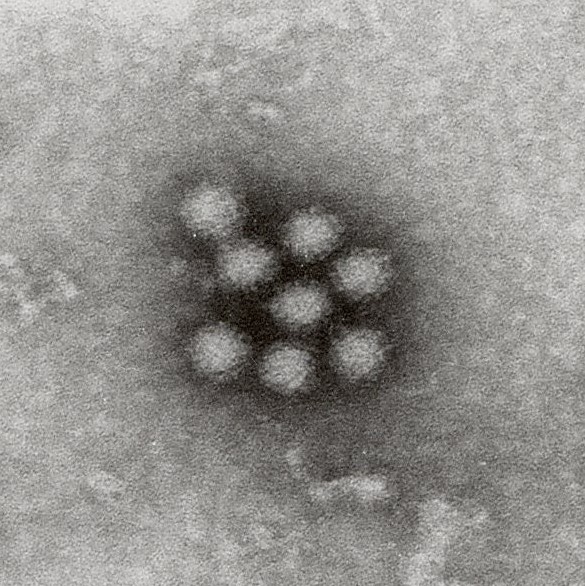 ノロウイルス画像