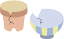 画像：陶磁器くずの絵