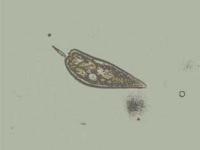 渦鞭毛藻類（Prorocentrum）の画像