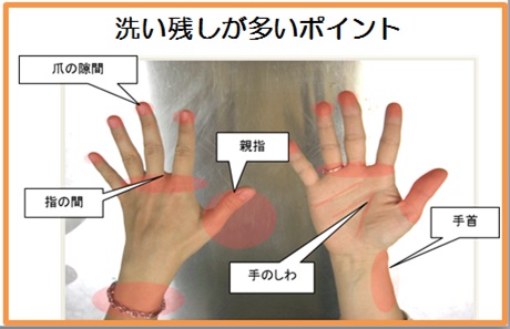 爪の隙間，指の間，親指，手のしわ，手首に洗い残しが多いです。