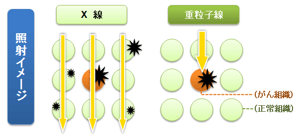 照射イメージを示す画像
