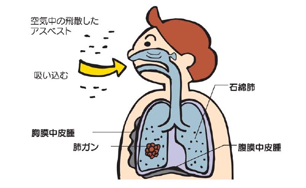 人体の画像
