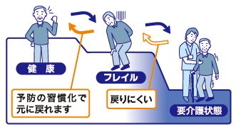 フレイルのイメージイラスト