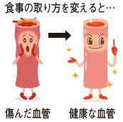 血管のイラスト(食事の取り方を変えると…傷んだ血管から健康な血管）